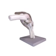 بازی آموزشی مدل مولاژ مفصل زانو