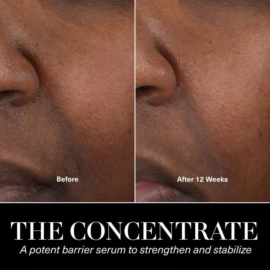 روغن صورت لامر مدل کنسانتره حجم 50 میلی لیتر