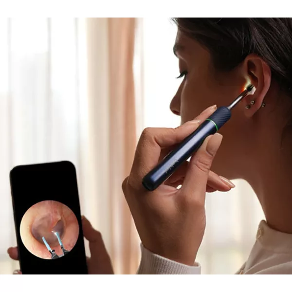 گوش پاک کن برقی ببیرد مدل Note 5