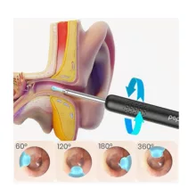 گوش پاک کن هوشمند بیبرد مدل R1