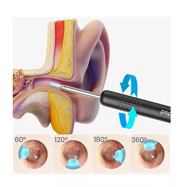 گوش پاک کن هوشمند بیبرد مدل R1