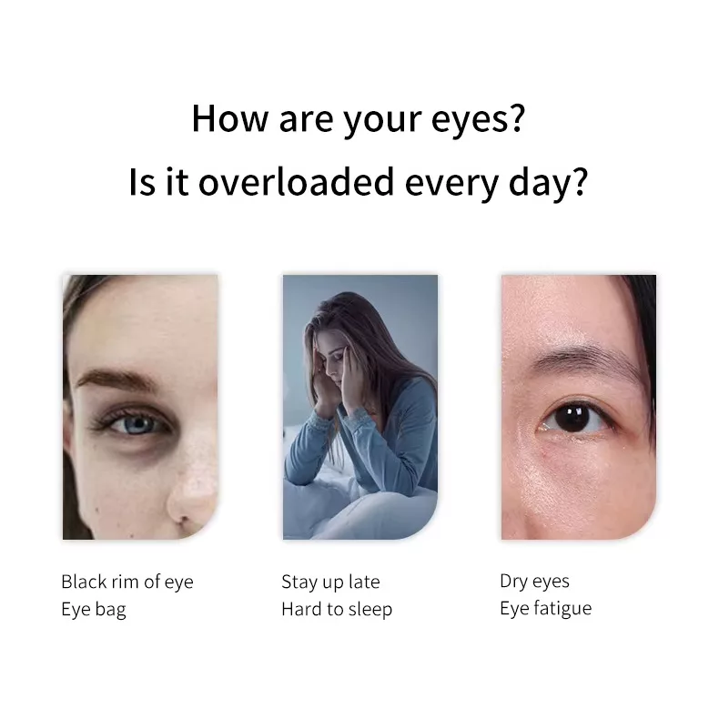 ماساژور چشم و سر رنفو مدل RelaxEyes