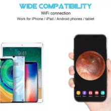 گوش پاک کن هوشمند بیبرد مدل R1 New Pack