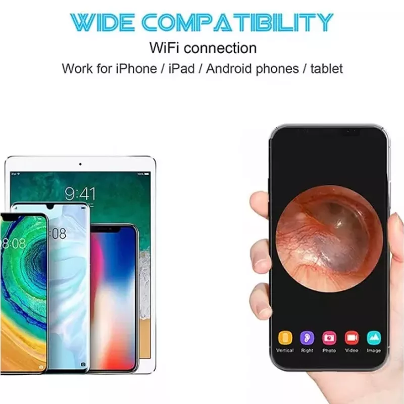 گوش پاک کن هوشمند بیبرد مدل R1 New Pack