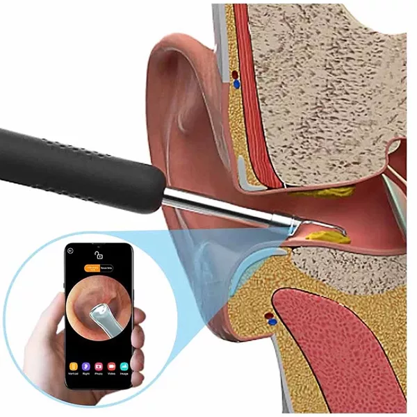 گوش پاک کن هوشمند بیبرد مدل R1