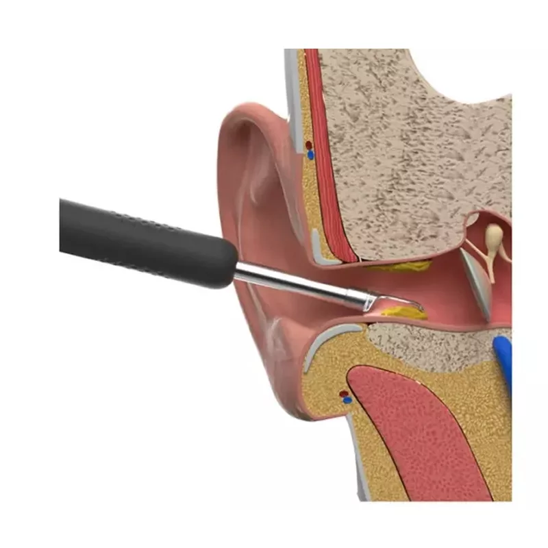 گوش پاک کن هوشمند بیبرد مدل R1 New Pack