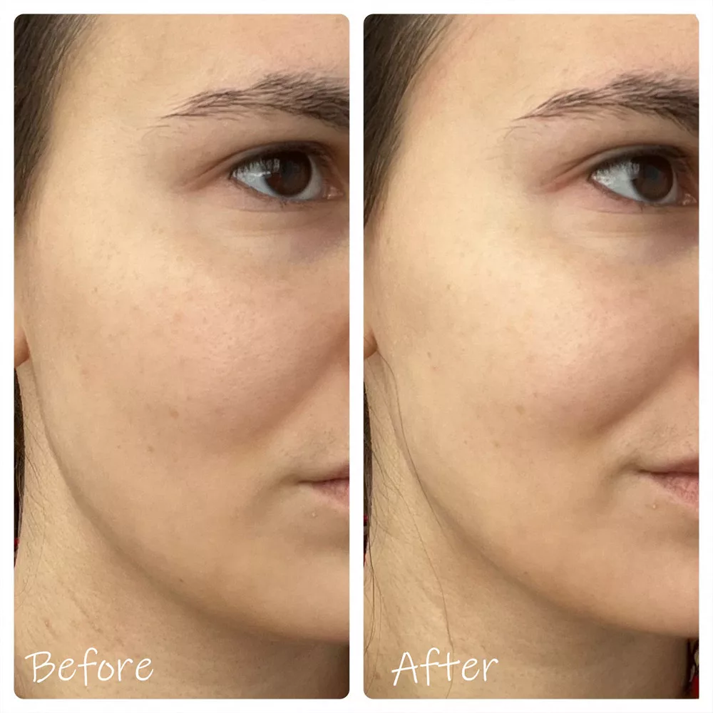 تونر سنتلا مدل HYALU-CICA Brightening حجم 210 میلی لیتر