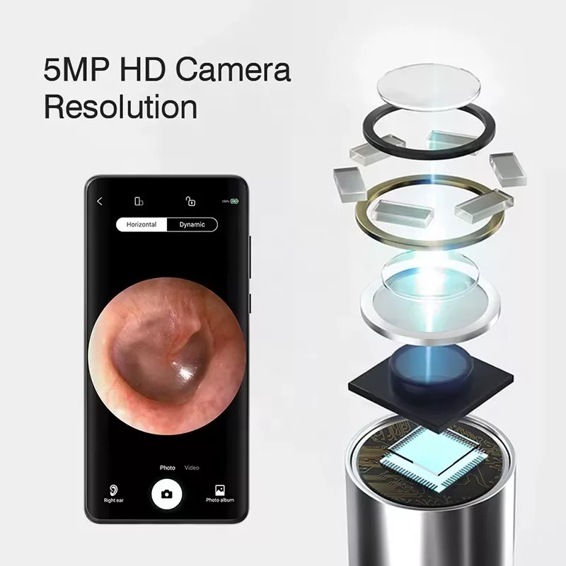 گوش پاک کن هوشمند مدل دوربین دار کد X5