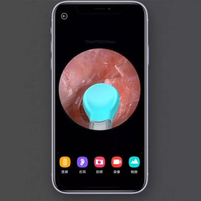 گوش پاک کن برقی ببرد مدل M9 Pro