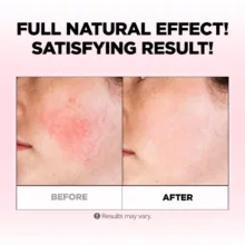 کرم آبرسان فارم اسکین مدل Soothing حجم 100 میلی لیتر