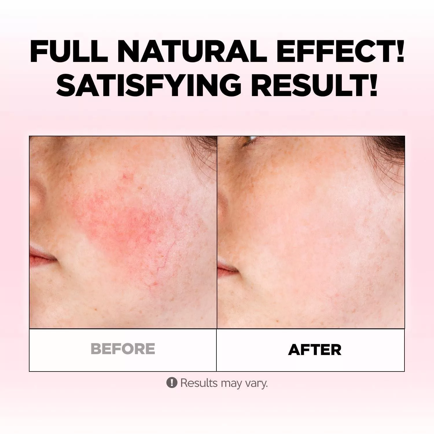 کرم آبرسان فارم اسکین مدل Soothing حجم 100 میلی لیتر