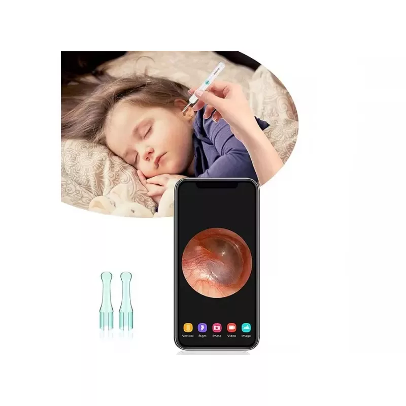 گوش پاک کن هوشمند بیبرد مدل R1 New Pack