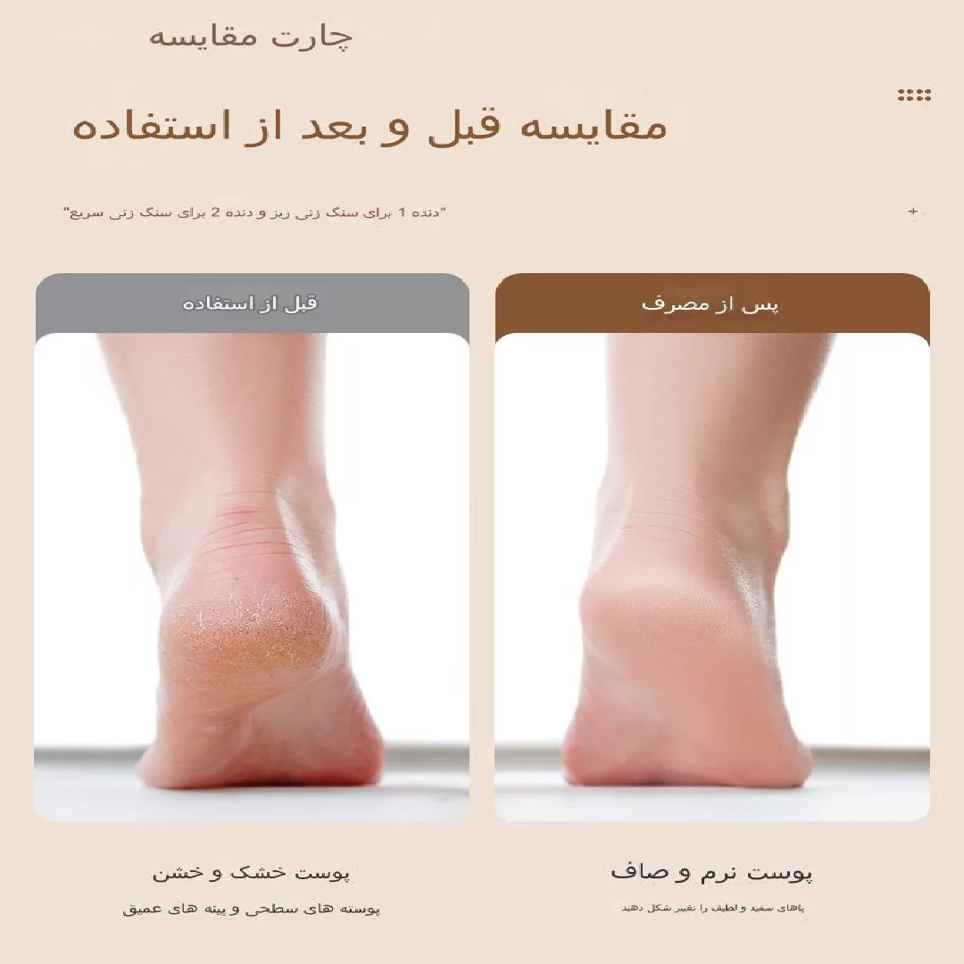 سنگ پا برقی مدل ZS-003