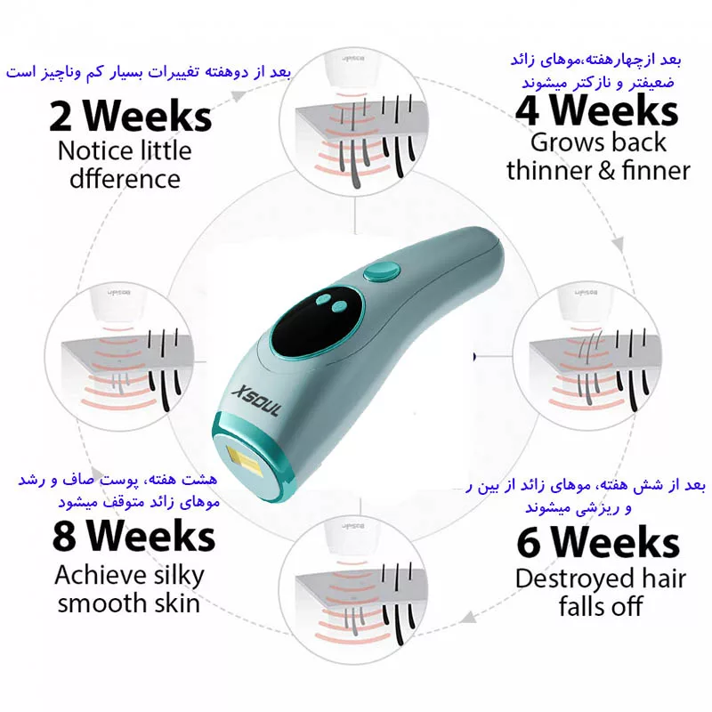 لیزر موهای زائد ایکسول مدل T-25