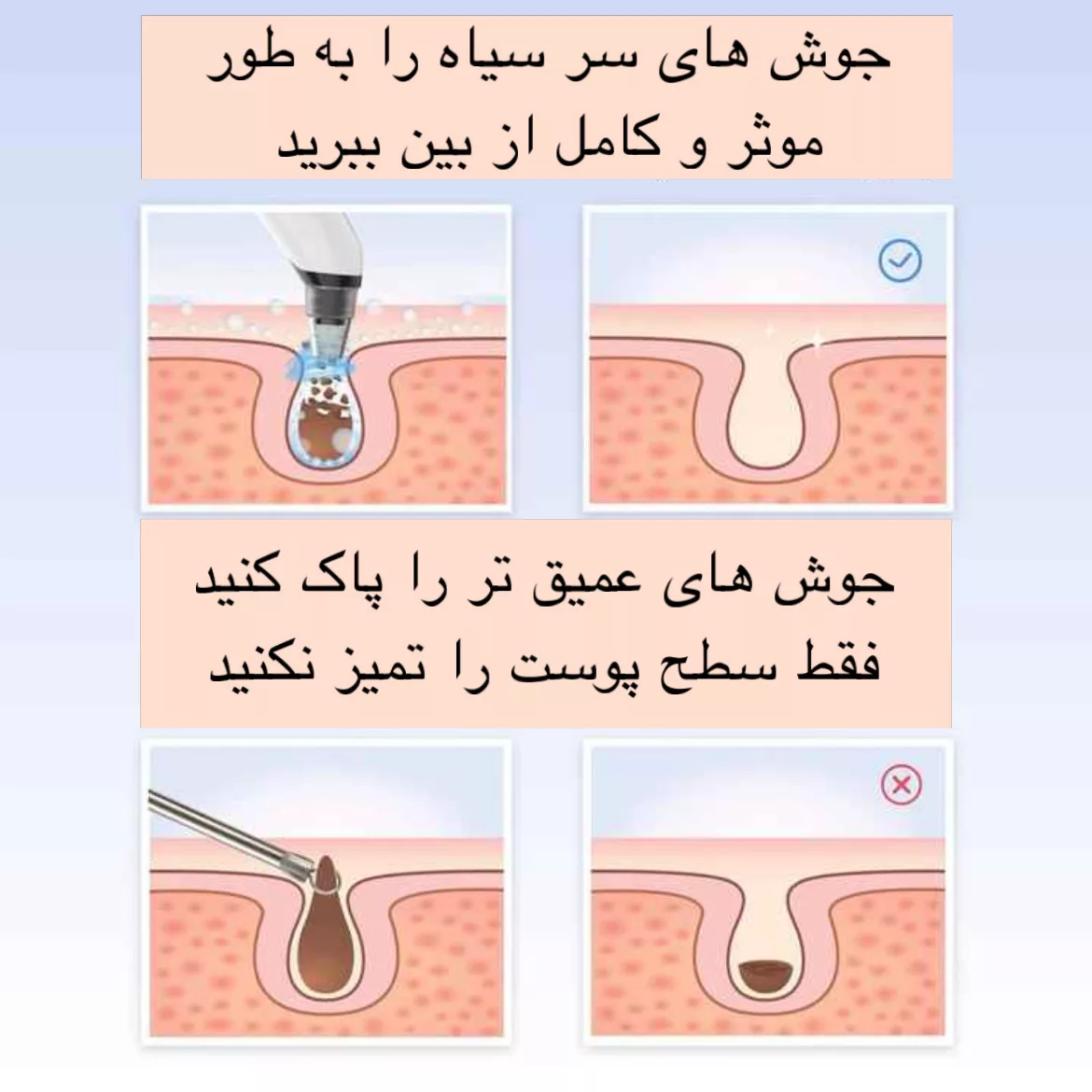 میکرودرم مدل X19