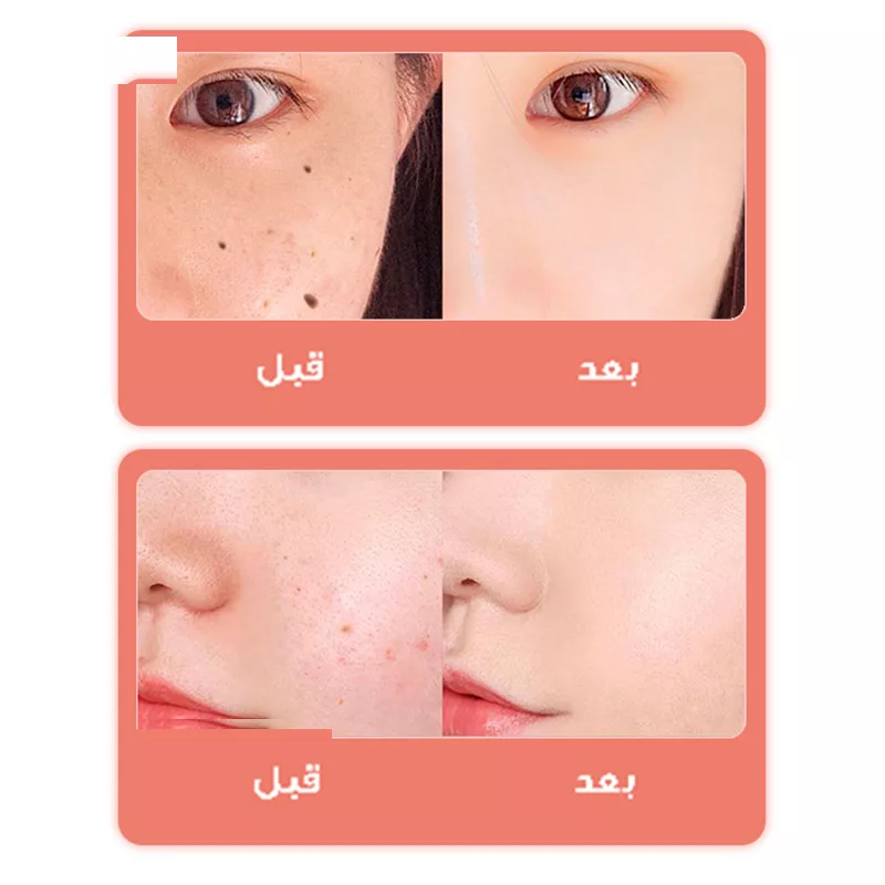 قلم پاک سازی پوست مدل دیجیتالی کد 9 سطح