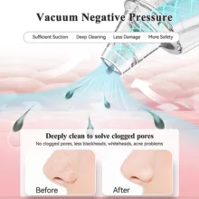 میکرودرم آنلن مدل GM001