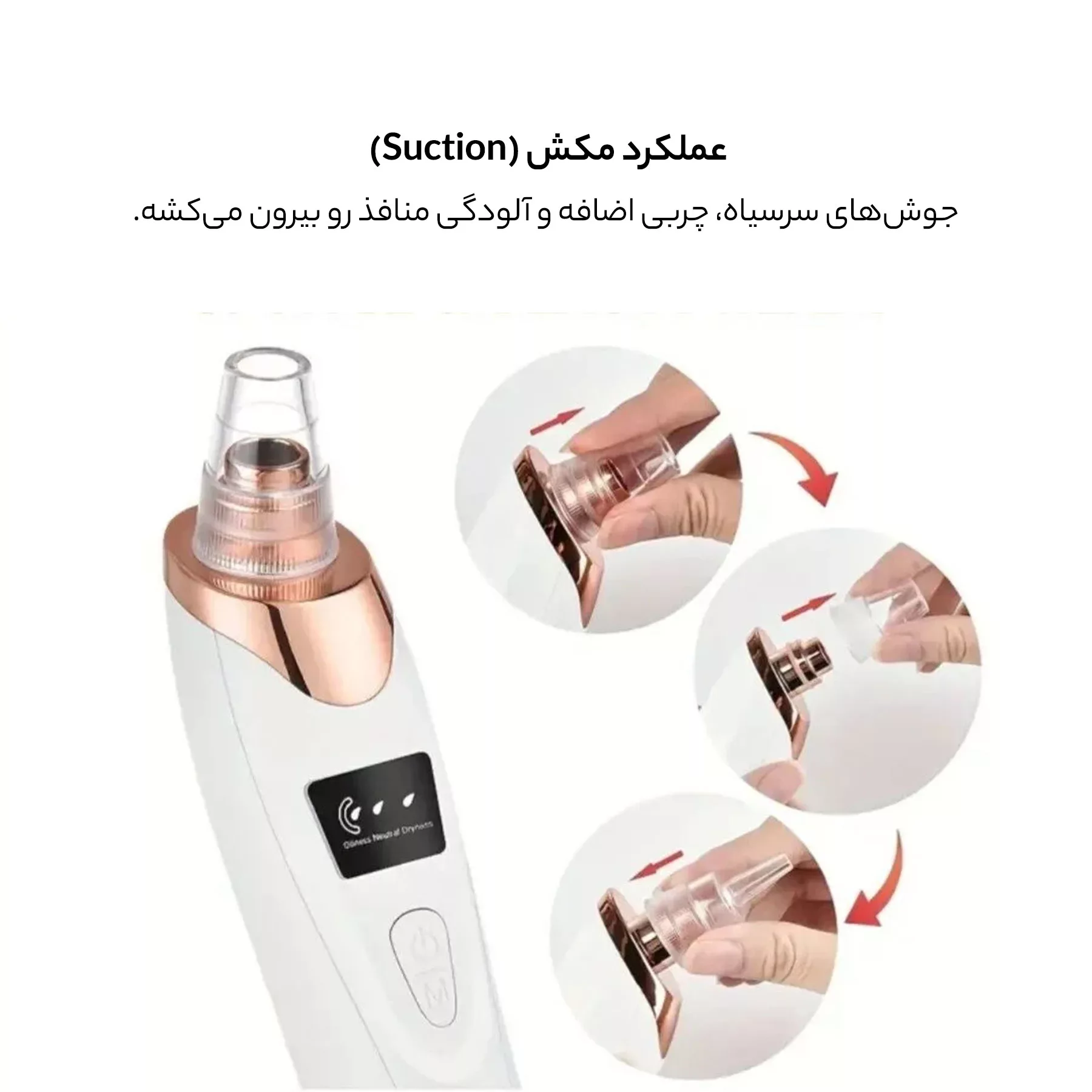 میکرودرم وینچر مدل Win