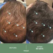 سرم تقویت کننده و ضد ریزش مو دی اس لابراتوریس مدل oltra مناسب برای موهای کم حجم نازک معمولی حجم 60 میلی لیتر
