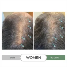 شامپو تقویت کننده و ضد ریزش مو دی اس لابراتوریس مدل Revita.CBD مناسب برای انواع مو حجم ۲۰۵ میلی لیتر
