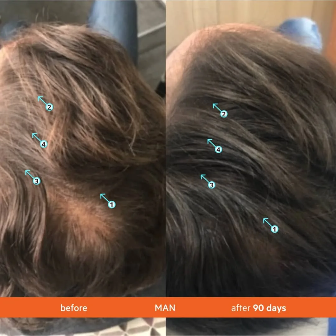 شامپو تقویت کننده و ضد ریزش مو دی اس لابراتوریس مدل High Performance مناسب برای شکننده، کمحجم و نازک حجم 205 میلی لیتر