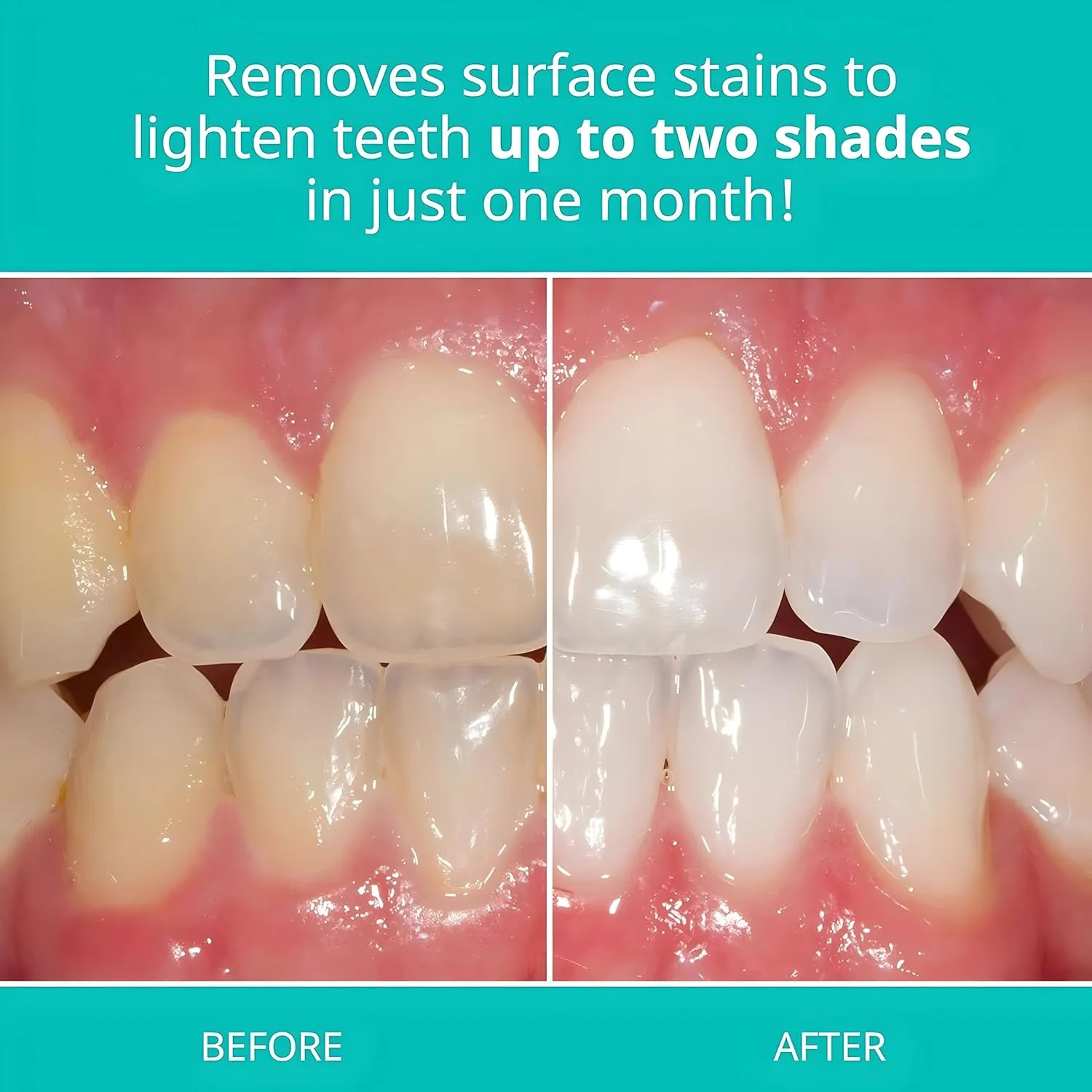 خمیردندان اوپالسنس مدل cool mint حجم 100 میلی لیتر