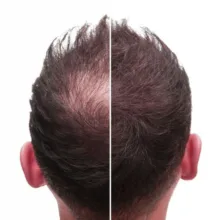 پودر پرپشت کننده مو تاپیک مدل FIBER وزن 50 گرم رنگ قهوه ای تیره مجموعه 2 عددی