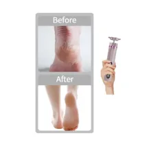 سنگ پا برقی مدل Amber Me C25