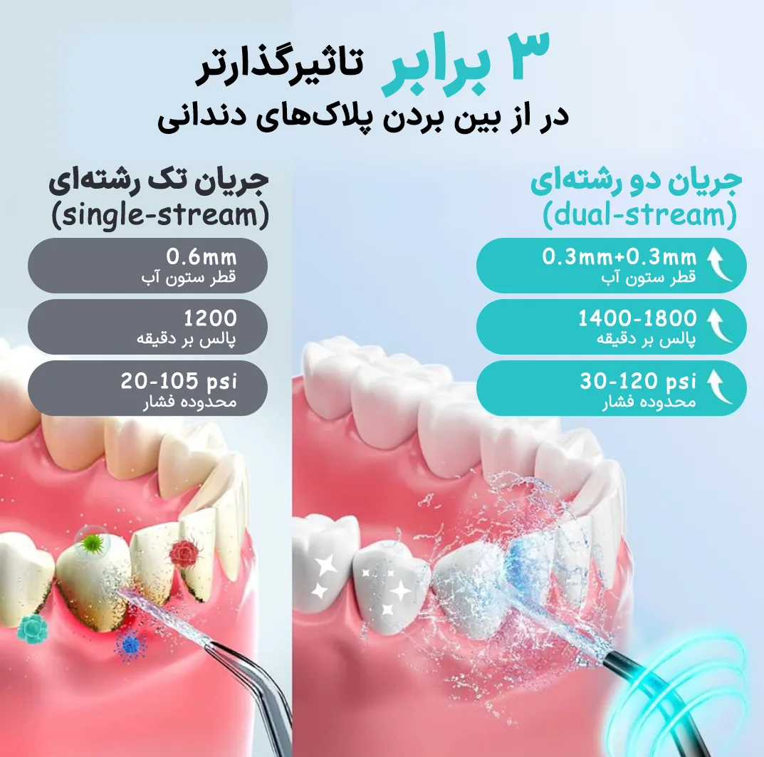 دستگاه شستوشوی دهان و دندان شارژی کاسلاس مدل COSLUS C30 به همراه 4 سری