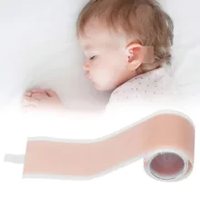 چسب اصلاح فرم گوش نوزاد کد 710
