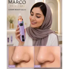 میکرودرم صورت مارکو مدل SMART-Class