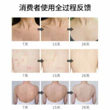 اسپری ضد جوش بدن سیازو رایکو مدل سنتلا آسیتکا حجم 150 میلی لیتر